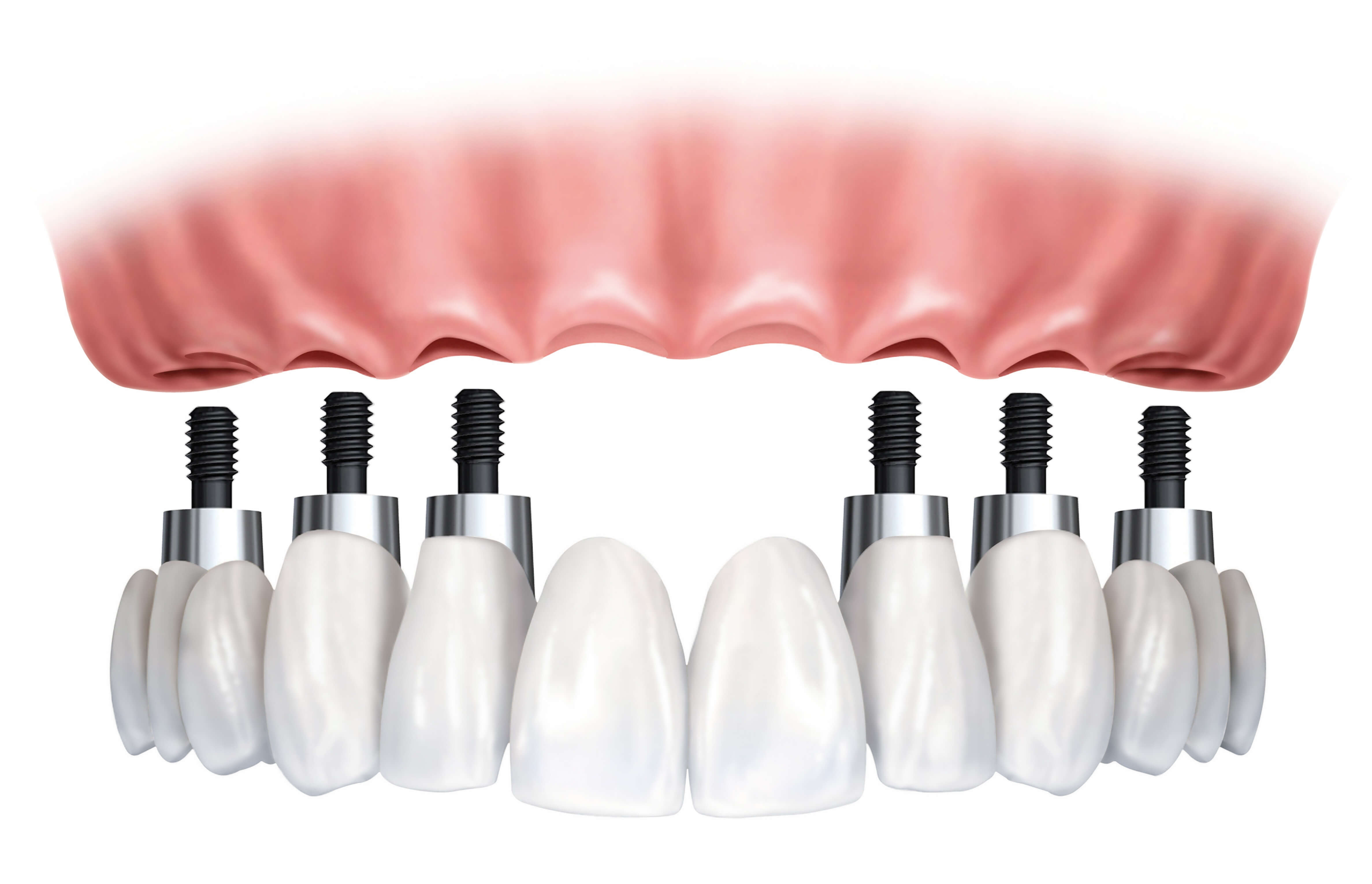 Yetişkin protez ve implantları